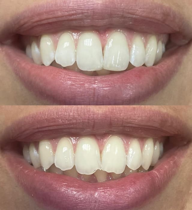 Image before and after treatment