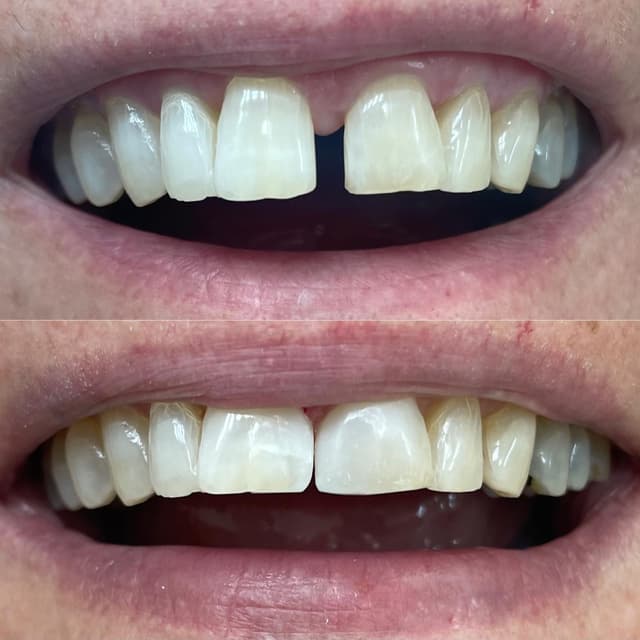 Image before and after treatment