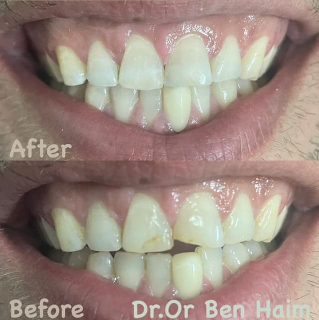 Image before and after treatment