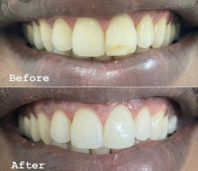 Image before and after treatment