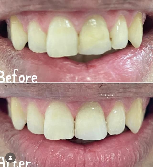 Image before and after treatment