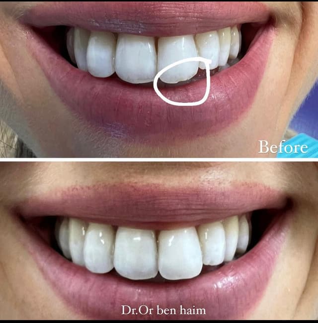 Image before and after treatment