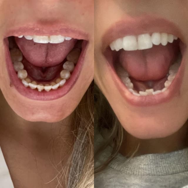 Image before and after treatment