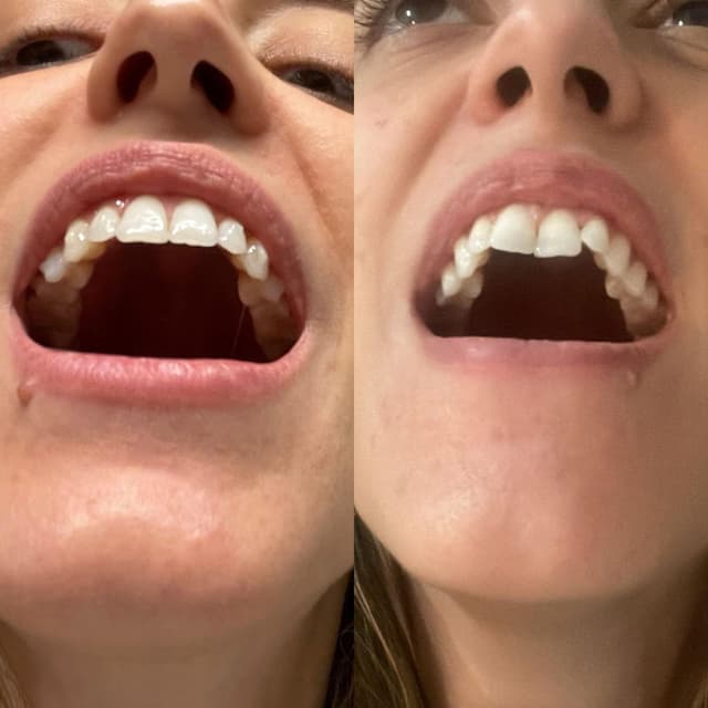 Image before and after treatment