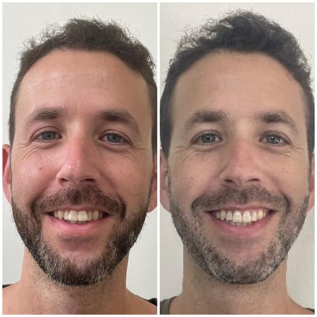 Image before and after treatment