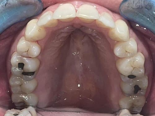 Image before and after treatment