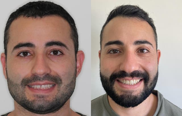 Image before and after treatment