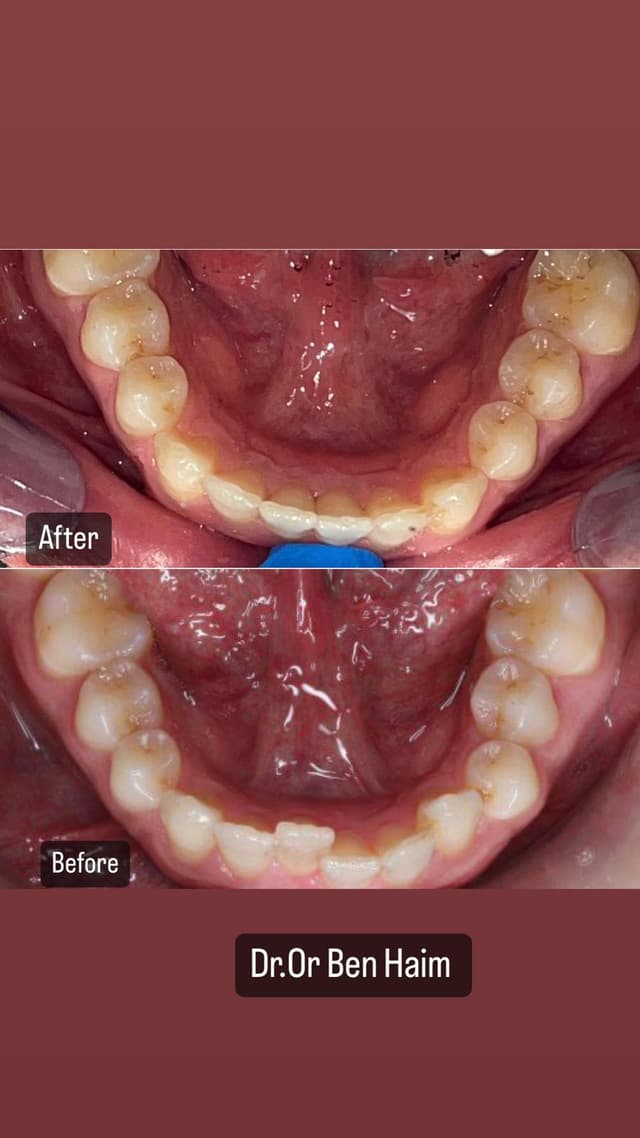 Image before and after treatment