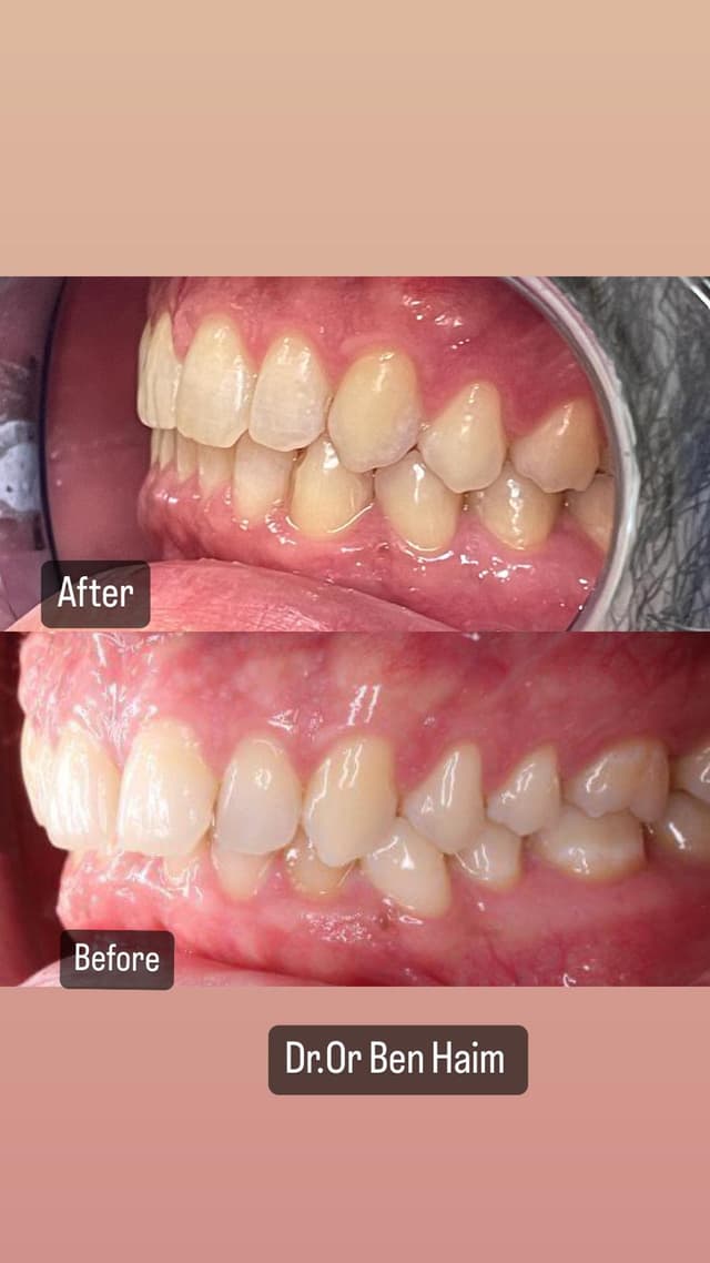 Image before and after treatment