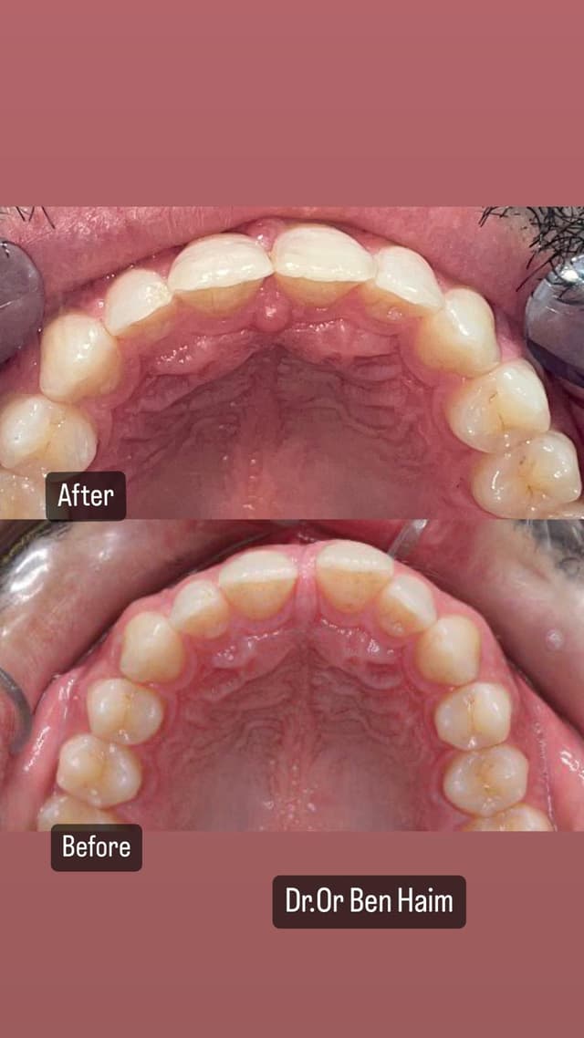 Image before and after treatment