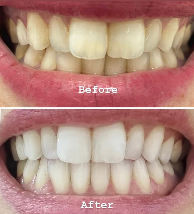 Image before and after treatment