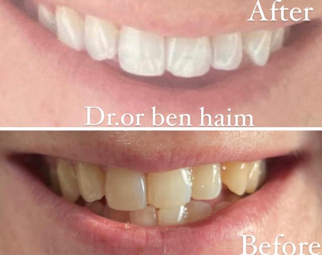 Image before and after treatment