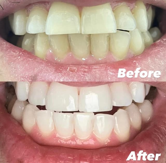 Image before and after treatment