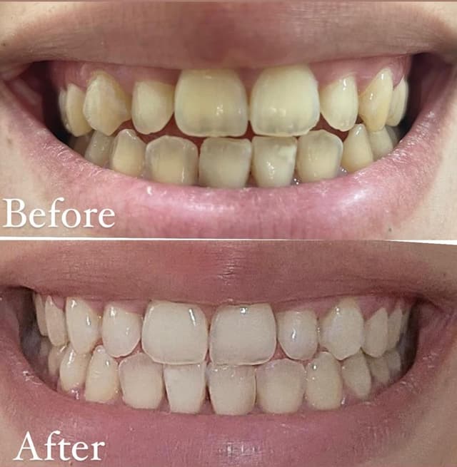 Image before and after treatment