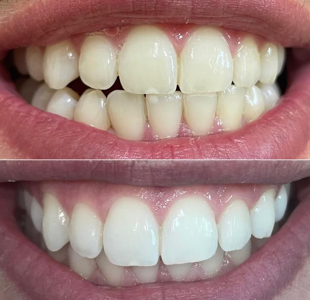 Image before and after treatment