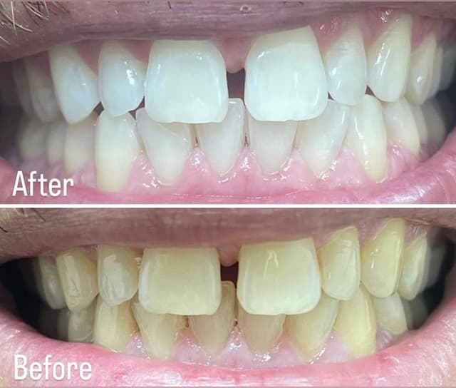 Image before and after treatment