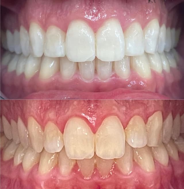 Image before and after treatment